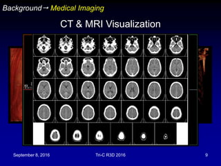 September 8, 2016 Tri-C R3D 2016 9
Background Medical Imaging
CT & MRI Visualization
 