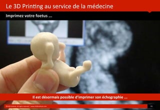 Le	
  3D	
  Prin?ng	
  au	
  service	
  de	
  la	
  médecine
Imprimez	
  votre	
  foetus	
  ...
	
  
	
  
©HUB	
  Ins?tute.	
  All	
  rights	
  reserved	
  	
  |	
  www.HUBins?tute.com 31	
  
Il	
  est	
  désormais	
  possible	
  d’imprimer	
  son	
  échographie	
  ...
 