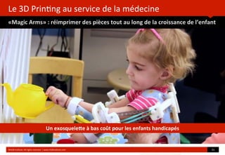 Le	
  3D	
  Prin?ng	
  au	
  service	
  de	
  la	
  médecine
«Magic	
  Arms»	
  :	
  réimprimer	
  des	
  pièces	
  tout	
  au	
  long	
  de	
  la	
  croissance	
  de	
  l’enfant
	
  
	
  
©HUB	
  Ins?tute.	
  All	
  rights	
  reserved	
  	
  |	
  www.HUBins?tute.com 31	
  
Un	
  exosquele[e	
  à	
  bas	
  coût	
  pour	
  les	
  enfants	
  handicapés
 