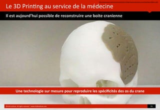 Le	
  3D	
  Prin?ng	
  au	
  service	
  de	
  la	
  médecine
Il	
  est	
  aujourd’hui	
  possible	
  de	
  reconstruire	
  une	
  boite	
  cranienne
hop://www.popsci.com/science/ar?cle/2013-­‐03/get-­‐brand-­‐new-­‐skull-­‐3-­‐d-­‐prin?ng?dom=‡&src=SOC
	
  
©HUB	
  Ins?tute.	
  All	
  rights	
  reserved	
  	
  |	
  www.HUBins?tute.com 31	
  
Une	
  technologie	
  sur	
  mesure	
  pour	
  reproduire	
  les	
  spéciﬁcités	
  des	
  os	
  du	
  crane
 