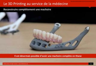 Le	
  3D	
  Prin?ng	
  au	
  service	
  de	
  la	
  médecine
Reconstruire	
  complétement	
  une	
  machoire
hop://www.singularityweblog.com/the-­‐ﬁrst-­‐3d-­‐printed-­‐jaw-­‐implant/
©HUB	
  Ins?tute.	
  All	
  rights	
  reserved	
  	
  |	
  www.HUBins?tute.com 31	
  
Il	
  est	
  désormais	
  possible	
  d’avoir	
  une	
  machoire	
  complète	
  en	
  (tane
 
