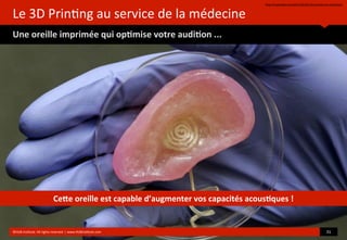 Le	
  3D	
  Prin?ng	
  au	
  service	
  de	
  la	
  médecine
Une	
  oreille	
  imprimée	
  qui	
  op(mise	
  votre	
  audi(on	
  ...
hop://mashable.com/2013/05/24/3d-­‐printed-­‐ear-­‐princeton/
©HUB	
  Ins?tute.	
  All	
  rights	
  reserved	
  	
  |	
  www.HUBins?tute.com 31	
  
Ce[e	
  oreille	
  est	
  capable	
  d’augmenter	
  vos	
  capacités	
  acous(ques	
  !
 