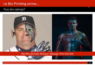 Le	
  Bio	
  Prin?ng	
  arrive…
Tous	
  des	
  cyborgs?	
  
	
  
	
  
©HUB	
  Ins?tute.	
  All	
  rights	
  reserved	
  	
  |	
  www.HUBins?tute.com 30	
  
#Greﬀes	
  illimitées	
  #Ethique	
  	
  #Dopage	
  	
  #Vie	
  éternelle
 