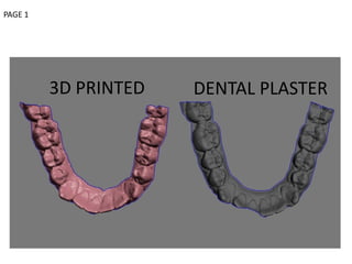 3D PRINTED DENTAL PLASTER
PAGE 1
 