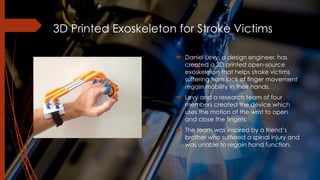 3D Printed Exoskeleton for Stroke Victims
! Daniel Levy, a design engineer, has
created a 3D printed open-source
exoskeleton that helps stroke victims
suffering from lack of finger movement
regain mobility in their hands.
! Levy and a research team of four
members created the device which
uses the motion of the wrist to open
and close the fingers.
! The team was inspired by a friend’s
brother who suffered a spinal injury and
was unable to regain hand function.
 