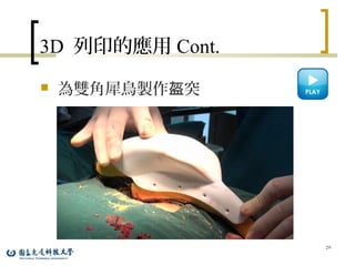 3D 列印的應用 Cont.
 為雙角犀鳥製作 突盔
29
 