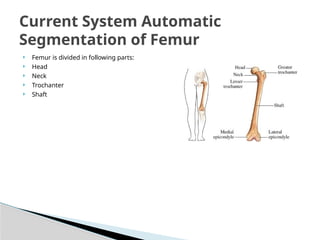  Femur is divided in following parts:
 Head
 Neck
 Trochanter
 Shaft
Current System Automatic
Segmentation of Femur
 