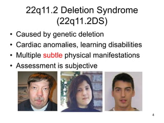 4
22q11.2 Deletion Syndrome
(22q11.2DS)
• Caused by genetic deletion
• Cardiac anomalies, learning disabilities
• Multiple...