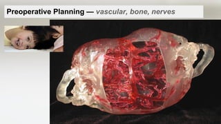 Preoperative Planning — vascular, bone, nerves