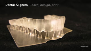 Dental Aligners— scan, design, print
growit3d.com