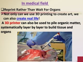 In medical field
Reprint Rather Than Wait For Organs
Not only can we use 3D printing to create art, we
can also create real life!
A 3D printer can also be used to pile organic matter,
systematically layer by layer to build tissue and
organs
 