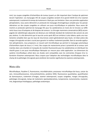 Résumé!
x!
mm).!Les!coupes!congelées!d’échantillons!de!tumeur!jouent!un!rôle!important!dans!l’analyse!de!spécimen!
durant!l’opération.!Les!marquages!IHC!de!coupes!congelées!seraient!d’un!grand!intérêt!lors!d’un!examen!
extemporané!si!seulement!le!temps!de!traitement!n’était!pas!une!limitation.!Dans!une!première!application!
péropératoire,!nous!avons!démontré!un!protocole!de!marquage!chromogénique!complet!pour!les!pancyt@
okératines! sur! des! coupes! congelées! en! utilisant! une! puce! microfluidique! en! polymère.! Nous! avons! dé@
montré!un!protocole!optimisé!de!marquage!IHC!pour!les!cytokératines!en!moins!de!12!minutes!sur!diffé@
rents!tissus!issus!d’autopsies!et!de!biopsies!de!tumeurs.!La!chirurgie!mammaire!conservatrice!(BCS)!accom@
pagnée!de!radiothérapie!adjuvante!est!devenue!une!méthode!standard!de!traitement!des!cancers!du!sein!
peu!sévères.!Il!a!été!démontré!que!le!taux!de!survie!après!BCS!est!similaire!à!celui!obtenu!après!une!mas@
tectomie!complète!bien!que!les!taux!de!récurrences!soient!généralement!plus!hauts.!Un!bilan!précis!des!
marges!chirurgicales!est!donc!crucial!pour!garantir!le!meilleur!traitement!possible.!Dans!la!seconde!applica@
tion!péropératoire,!nous!proposons!un!nouvel!outil!microfluidique!qui!permet!le!marquage!automatique!
d’échantillons!épais!de!tissus!(>!2!mm).!Des!coupes!de!mastectomie!prises!à!proximité!de!la!tumeur!sont!
insérées!dans!une!chambre!et!marquées!de!manière!fluorescente!pour!les!cytokératines!en!distribuant!les!
réactifs!grace!à!une!puce!microfluidique!fabriquée!sur!mesure!pour!cette!application.!Les!dimensions!du!
système! microfluidique! utilisé! dans! ces! études! sont! compatibles! avec! les! contraintes! d’espace! d’un! la@
boratoire!d’examen!extemporané.!Nous!croyons!que!l’adoption!des!technologies!microfluidiques!dans!le!
champ!de!la!pathologie!chirurgicale!peut!améliorer!de!manière!signifcative!les!examens!extemporanés.!
Mots8clés.
Microfluidique,!Parylène!C,!fluorescence,!microfabrication,!processeur!microfluidique!de!tissus,!cancer!du!
sein,! immunofluorescence,! immunohistochimie,! protéine! HER2,! fluorescence! quantitative,! quantification!
de! biomarqueurs,! traitement! d’images,! examen! extemporané,! coupes! congelées,! marges! chirurgicales,!
pathologie!chirurgicale,!temps!de!traitement,!(pan)cytokeratines,!lumpectomie,!tumorectomie,!mastecto@
mie,!diagnostique!histologique,!pathologie!anatomique.!
!
!
 