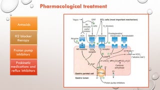 Reflux Inhibitor Gastro-esophageal Reflux Disease | PDF