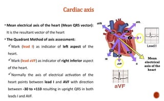 3 Electrocardiogram (ECG) basics_2026.pptx