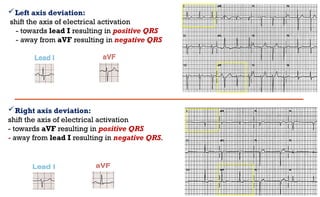 3 Electrocardiogram (ECG) basics_2026.pptx