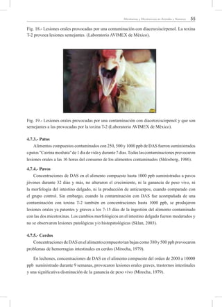 55Micotoxinas y Micotoxicosis en Animales y Humanos
Fig. 18.- Lesiones orales provocadas por una contaminación con diacetoxiscirpenol. La toxina
T-2 provoca lesiones semejantes. (Laboratorio AVIMEX de México).
Fig. 19.- Lesiones orales provocadas por una contaminación con diacetoxiscirpenol y que son
semejantes a las provocadas por la toxina T-2 (Laboratorio AVIMEX de México).
4.7.3.- Patos
Alimentos compuestos contaminados con 250, 500 y 1000 ppb de DAS fueron suministrados
apatos"Cairinamoshata"de1díadevidaydurante7días.Todaslascontaminacionesprovocaron
lesiones orales a las 16 horas del consumo de los alimentos contaminados (Shlosberg, 1986).
4.7.4.- Pavos
Concentraciones de DAS en el alimento compuesto hasta 1000 ppb suministradas a pavos
jóvenes durante 32 días y más, no alteraron el crecimiento, ni la ganancia de peso vivo, ni
la morfología del intestino delgado, ni la producción de anticuerpos, cuando comparado con
el grupo control. Sin embargo, cuando la contaminación con DAS fue acompañada de una
contaminación con toxina T-2 también en concentraciones hasta 1000 ppb, se produjeron
lesiones orales ya patentes y graves a los 7-15 días de la ingestión del alimento contaminado
con las dos micotoxinas. Los cambios morfológicos en el intestino delgado fueron moderados y
no se observaron lesiones patológicas y/o histopatológicas (Sklan, 2003).
4.7.5.- Cerdos
Concentraciones de DAS en el alimento compuesto tan bajas como 380 y 500 ppb provocaron
problemas de hemorragias intestinales en cerdos (Mirocha, 1979).
En lechones, concentraciones de DAS en el alimento compuesto del orden de 2000 a 10000
ppb suministrado durante 9 semanas, provocaron lesiones orales graves, trastornos intestinales
y una significativa disminución de la ganancia de peso vivo (Mirocha, 1979).
 