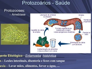 Protozoários - Saúde
Protozooses:
Amebíase
gente Etiológico - Entamoeba histolytica
s – Lesões intestinais, disenteria e fezes com sangue
axia – Lavar mãos, alimentos, ferver a água, ...
 