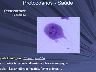 Protozoários - Saúde
Protozooses:
Giardíase
gente Etiológico - Giardia lamblia
s – Lesões intestinais, disenteria e fezes com sangue
axia – Lavar mãos, alimentos, ferver a água, ...
 