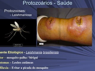 Protozoários - Saúde
Protozooses:
Leishmaniose
tor – mosquito-palha / birigui
gente Etiológico - Leishmania brasiliensis
ntomas – Lesões cutâneas
filaxia – Evitar a picada do mosquito
 