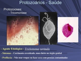 Protozoários - Saúde
Protozooses:
Tricomoníase
- Agente Etiológico - Trichomonas vaginalis
- Sintomas – Corrimento esverdeado, mau cheiro no órgão genital
- Profilaxia – Não usar roupas ou fazer sexo com pessoas contaminadas
 