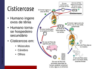 Cisticercose
● Humano ingere
ovos de tênia
● Humano torna-
se hospedeiro
secundário
● Cisticercos em:
● Músculos
● Cérebro
● Olhos
Imagem:www.tuasaude.com
 