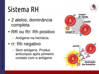 Sistema RH
● 2 alelos, dominância
completa
● RR ou Rr: Rh positivo
– Antígeno na hemácia
● rr: Rh negativo
– Sem antígeno. Produz
anticorpos após primeiro
contato com o antígeno
Imagem:http://www.mundoeducacao.com
 