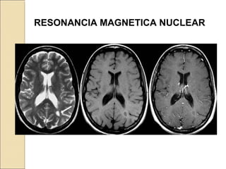 RESONANCIA MAGNETICA NUCLEAR
 