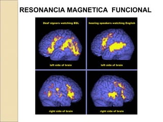 RESONANCIA MAGNETICA FUNCIONAL
 