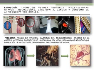 patologia hemodinamica, neoplasias, amibiasis, criptococcosis y rabia | PDF