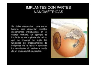 IMPLANTES CON PARTES
                 NANOMÉTRICAS


Se debe desarrollar una nano-
batería para alimentar posibles
mecanismos introducidos en el
cuerpo humano. Un ejemplo de
implante es un implante de retina,
que se encarga de suplir las
funciones de procesamiento de
imágenes de la retina y transmitir
los resultados al cerebro a través
de un grupo de 50 electrodos.
 