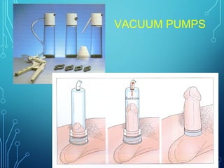 VACUUM PUMPS
 