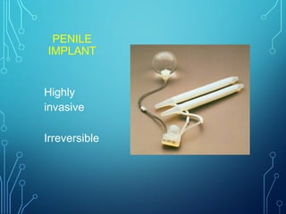 PENILE
IMPLANT
Highly
invasive
Irreversible
 