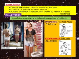 Special NEEDS 
PREGNANCY proteins, calcium, vitamin D, folic Acid 
LACTATION  proteins, vitamins, calcium 
GROWING CHILDREN  calcium, iron, vitamin D, vitamin A (disease 
resistance) 
MALNUTRITION 
insufficient, excessive or imbalanced comsuptiom of nutrients 
MARASMUS no food intake, 
E deficency 
KWASHIORKORpot belly/ 
no proteins 
 