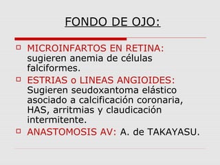 FONDO DE OJO:
 MICROINFARTOS EN RETINA:
sugieren anemia de células
falciformes.
 ESTRIAS o LINEAS ANGIOIDES:
Sugieren seudoxantoma elástico
asociado a calcificación coronaria,
HAS, arritmias y claudicación
intermitente.
 ANASTOMOSIS AV: A. de TAKAYASU.
 