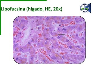 Lipofucsina (hígado, HE, 20x)
 