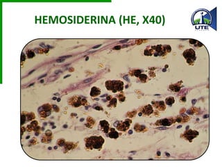 HEMOSIDERINA (HE, X40)
 