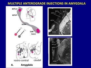 MULTIPLE ANTEROGRADE INJECTIONS IN AMYGDALA
 