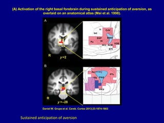 (A) Activation of the right basal forebrain during sustained anticipation of aversion, as
overlaid on an anatomical atlas (Mai et al. 1998).
Daniel W. Grupe et al. Cereb. Cortex 2013;23:1874-1883
Sustained anticipation of aversion
 