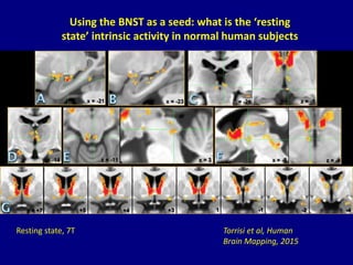 Torrisi et al, Human
Brain Mapping, 2015
Resting state, 7T
Using the BNST as a seed: what is the ‘resting
state’ intrinsic activity in normal human subjects
 