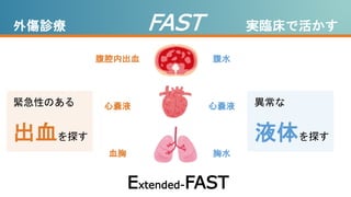 外傷診療 FAST 実臨床で活かす
緊急性のある
出血を探す
腹腔内出血
心嚢液
血胸
腹水
心嚢液
胸水
異常な
液体を探す
Extended-FAST
 