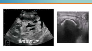 腸管膜の世界
腸管膜の世界
 