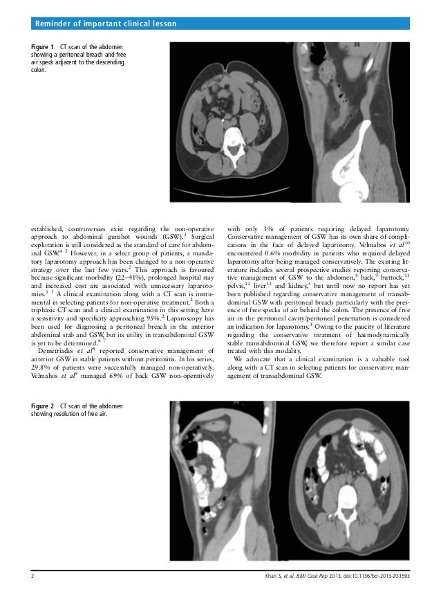 BMJ Case Reports2013Khanbcr2013201593