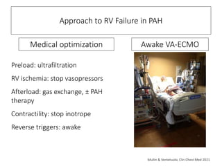 What Is Rv Preload Mechanical Circulatory Support of the Failing Right Ventricle | PPTX