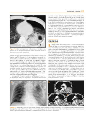 Evi Ria Urgencias radiologicas_Radiologia_en_Urgencias_-_seram.pdf