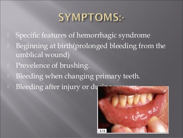 Hemorrhagic diathesis pathogenesis picture