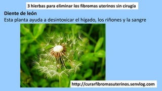 3 hierbas para eliminar los fibromas uterinos sin cirugía
Diente de león
Esta planta ayuda a desintoxicar el hígado, los riñones y la sangre
http://curarfibromasuterinos.senvlog.com
 