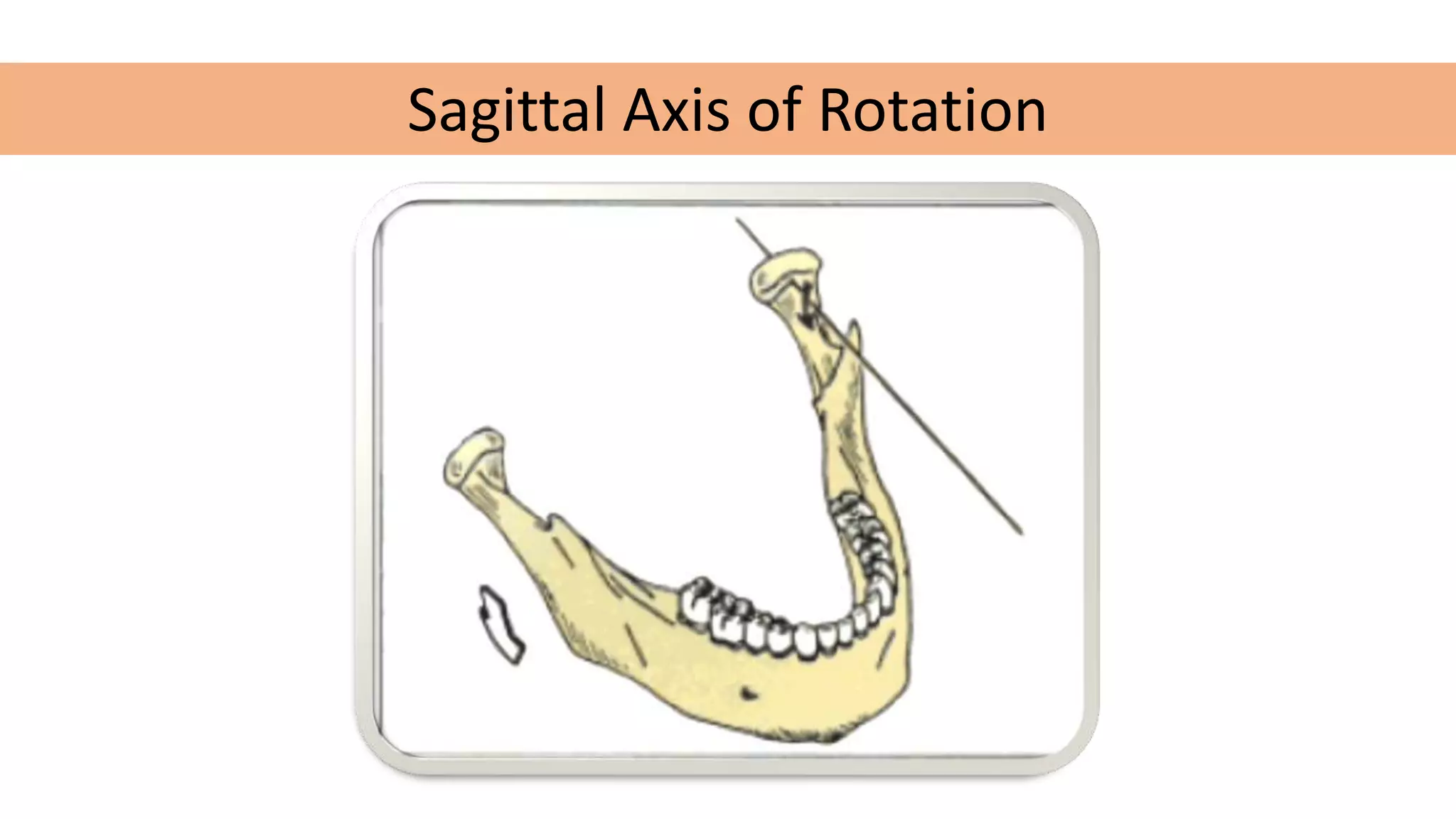 hinge axis | PPTX
