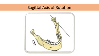 Sagittal Axis of Rotation
 