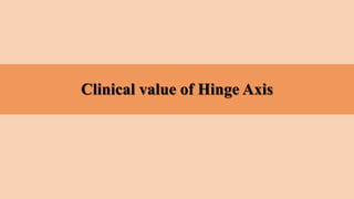 Clinical value of Hinge Axis
 