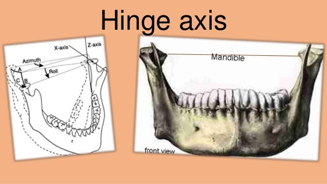 hinge axis posselt s diagram 